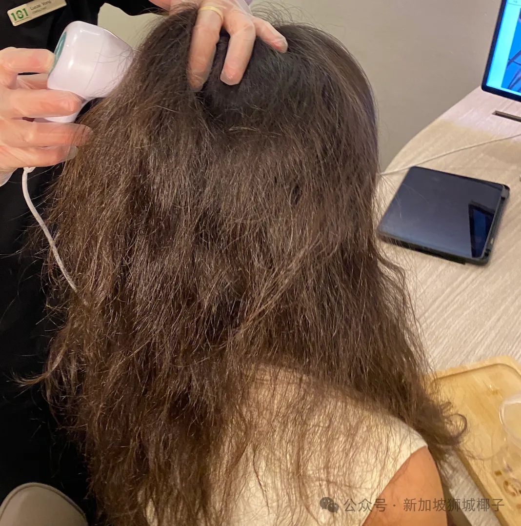 好脏啊！新加坡小姐姐发量这么大，竟然......